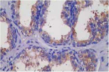 黯IHC